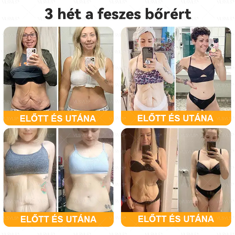 Magyarországról készült és szállított🐝VLSVLS® Méhméreg Bőrfelújító Krém 🔥 UTOLSÓ NAP – 80% KEDVEZMÉNY🔥