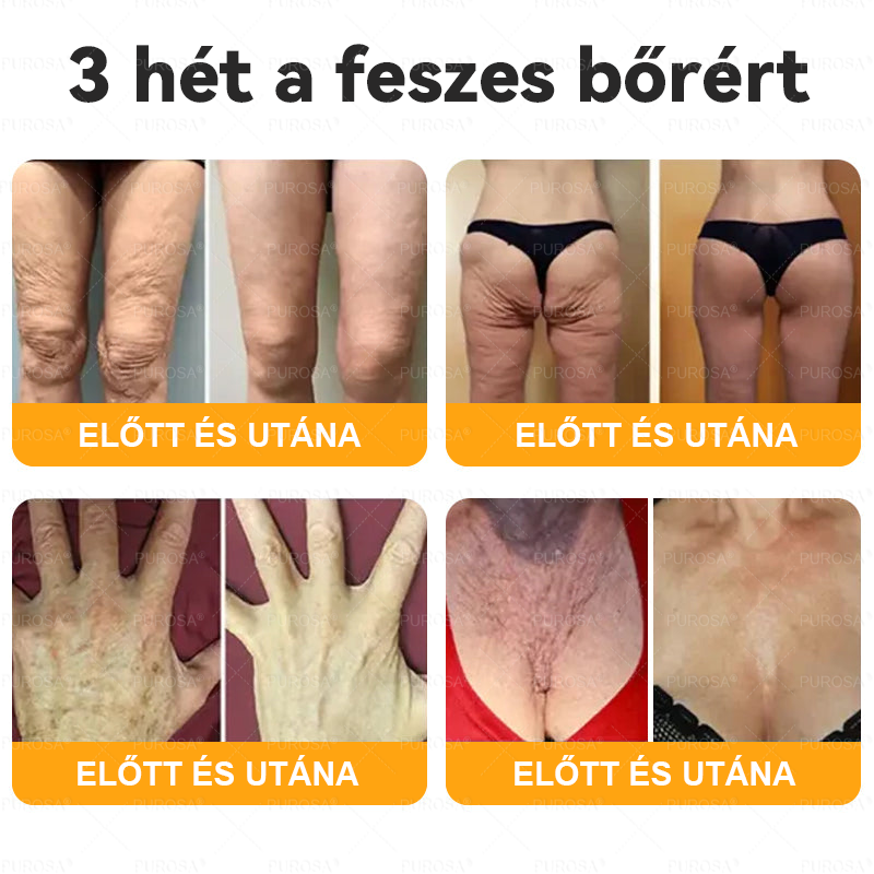⏰ Már csak 5 doboz maradt! További 50% kedvezményt kínálunk! Maradj fitt és egészséges. Ha most veszítesz, jövőre nem kapsz újabb esélyt.