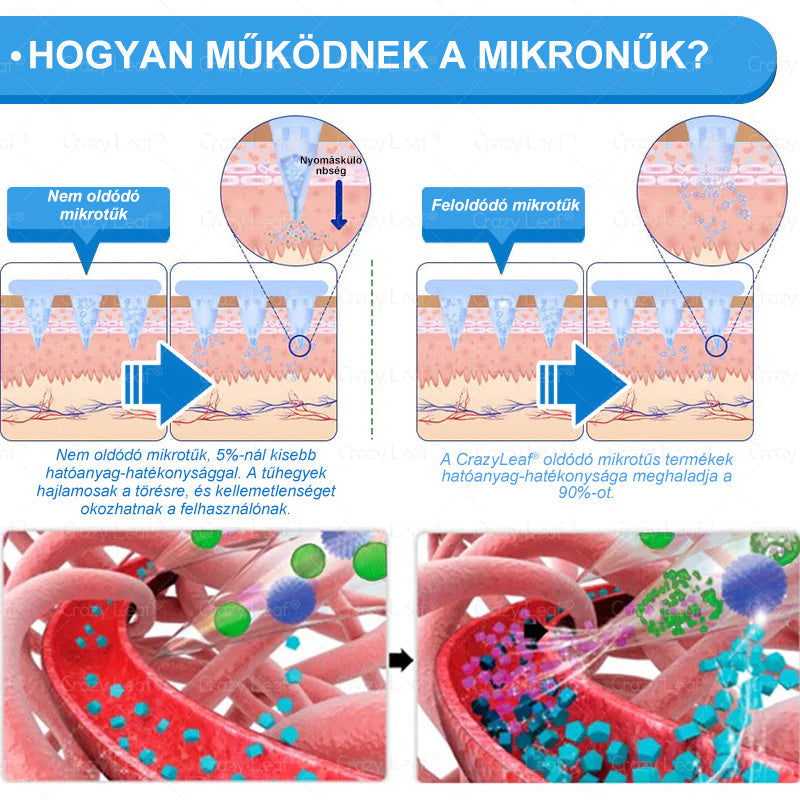 Klinikailag igazolt|Hivatalos webáruház|𝐶𝑟𝑎𝑧𝑦𝐿𝑒𝑎𝑓® SMGT- GLP-1 Nano mikrotüs, vékonyés erős tapasz|Célzott hatás elhízás, megereszkedett bőr, magas vérnyomás, cukorbetegség, zsírmáj, ízületi fájdalmak, testi fájdalmak és egyéb panaszok esetén