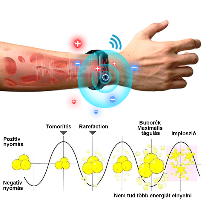 ⌚🩵𝟐𝟎𝟐𝟒 𝐥𝐞𝐠ú𝐣𝐚𝐛𝐛 𝐁𝐒𝐖𝐄𝐋𝐋™ ultrahangos zsírfúvó és méregtelenítő csuklópántja – energiaegyensúly ⏱️ (utolsó napi 80% kedvezmény + orvos által ajánlott)