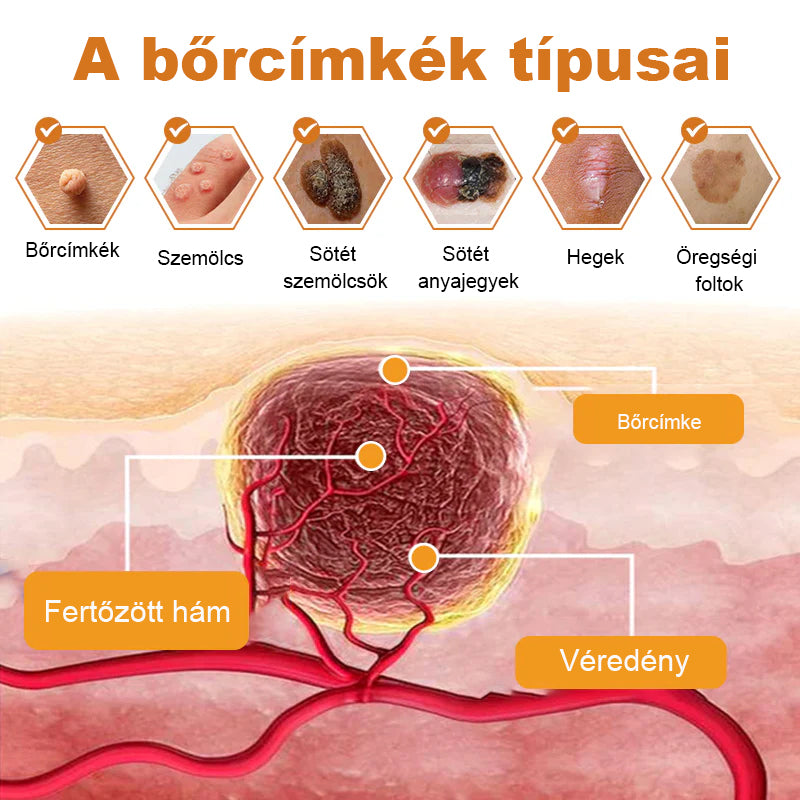 🌸🌞[✨Hivatalos Márka Bolt✨] 𝑻𝒖𝒓𝒐𝒏𝒖™ Gyógynövényes és szemölcskezelő krém (👨‍⚕️Orvosok ajánlása)