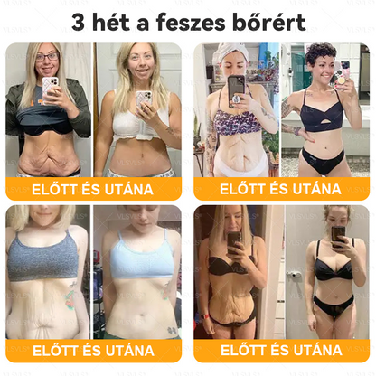 Magyarországról készült és szállított🐝VLSVLS® Méhméreg Bőrfelújító Krém 🔥 UTOLSÓ NAP – 80% KEDVEZMÉNY🔥