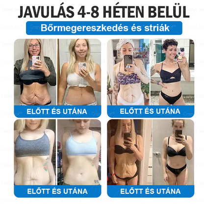 Klinikailag igazolt｜Hivatalos webáruház｜𝐶𝑟𝑎𝑧𝑦𝐿𝑒𝑎𝑓® SMGT- GLP-1 Nano mikrotüs, vékonyés erős tapasz｜Célzott hatás elhízás, megereszkedett bőr, magas vérnyomás, cukorbetegség, zsírmáj, ízületi fájdalmak, testi fájdalmak és egyéb panaszok esetén