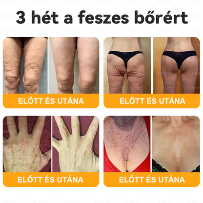 Magyarországról készült és szállított🐝VLSVLS® Méhméreg Bőrfelújító Krém 🔥 UTOLSÓ NAP – 80% KEDVEZMÉNY🔥