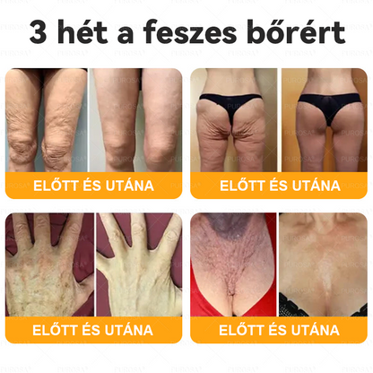 ⏰ Már csak 5 doboz maradt! További 50% kedvezményt kínálunk! Maradj fitt és egészséges. Ha most veszítesz, jövőre nem kapsz újabb esélyt.