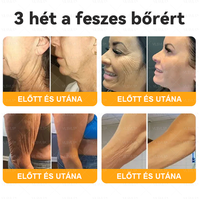 Magyarországról készült és szállított🐝VLSVLS® Méhméreg Bőrfelújító Krém 🔥 UTOLSÓ NAP – 80% KEDVEZMÉNY🔥