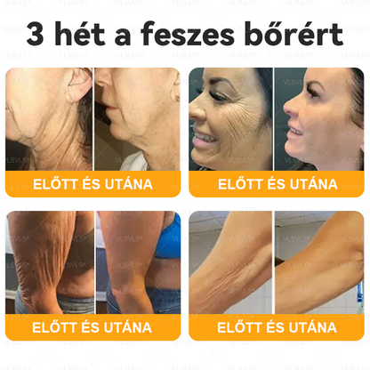 Magyarországról készült és szállított🐝VLSVLS® Méhméreg Bőrfelújító Krém 🔥 UTOLSÓ NAP – 80% KEDVEZMÉNY🔥