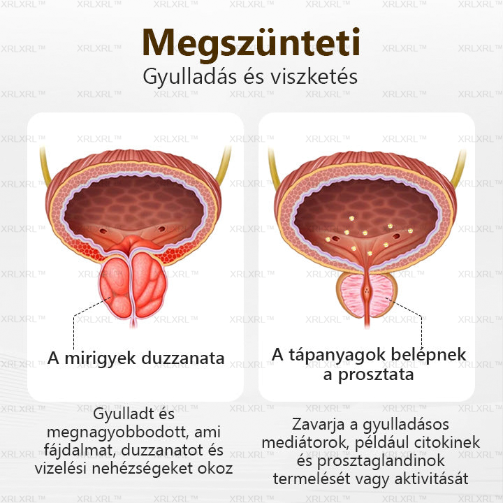 XRLXRL® ProstaVibe Méh Egészség Inhalátor