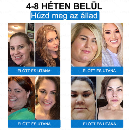 Klinikailag igazolt｜Hivatalos webáruház｜𝐶𝑟𝑎𝑧𝑦𝐿𝑒𝑎𝑓® SMGT- GLP-1 Nano mikrotüs, vékonyés erős tapasz｜Célzott hatás elhízás, megereszkedett bőr, magas vérnyomás, cukorbetegség, zsírmáj, ízületi fájdalmak, testi fájdalmak és egyéb panaszok esetén