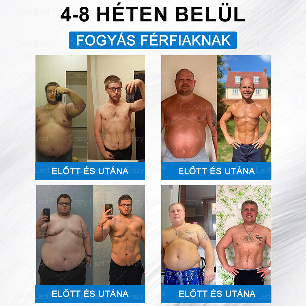 Klinikailag igazolt｜Hivatalos webáruház｜𝐶𝑟𝑎𝑧𝑦𝐿𝑒𝑎𝑓® SMGT- GLP-1 Nano mikrotüs, vékonyés erős tapasz｜Célzott hatás elhízás, megereszkedett bőr, magas vérnyomás, cukorbetegség, zsírmáj, ízületi fájdalmak, testi fájdalmak és egyéb panaszok esetén