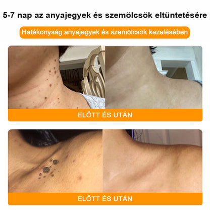 🌸🎁 Már csak 5 doboz maradt! További 50% kedvezményt biztosítunk! Legyen fitt és egészséges. Ha most veszít, csak jövőre lesz esélye.